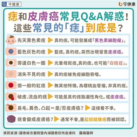 左眼下突然長痣|是痣or皮膚癌？醫「1張圖秒對照」 長這2部位最危險 